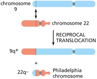 Philadelphia chromosome translocation between chromosomes 9 and 22