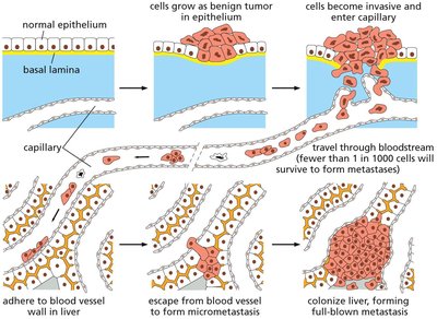Steps in the process of metastasis