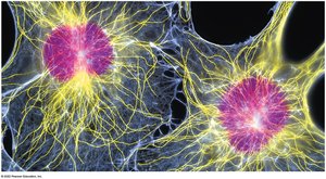 Fluorescent image of cytoskeletal elements in cells: red = microtubules, yellow = microfilaments, blue = intermediate filaments