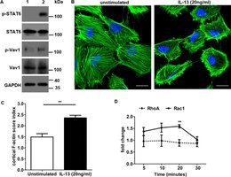 Actin filaments in microvilli and cell cortex