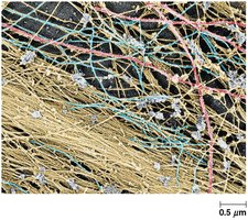 Electron micrograph showing microtubules (red), microfilaments (yellow), and intermediate filaments (blue)