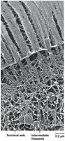 Terminal web and intermediate filaments in microvilli