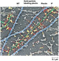 Gold particle labeling plectin linking MT, IF, and MF