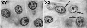 Microscopy image showing Barr bodies in XX cells