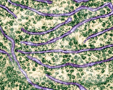Electron micrograph of rough ER showing ribosomes