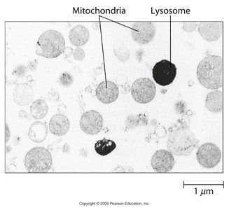 Electron micrograph showing lysosomes and mitochondria
