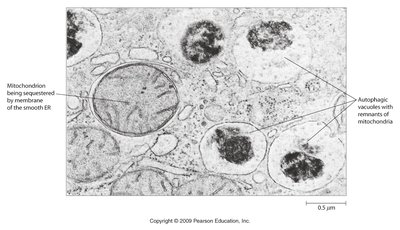 Electron micrograph of autophagic vacuoles