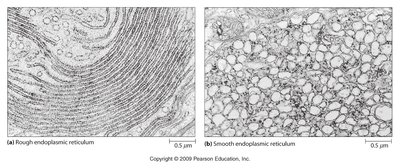 Electron micrographs of rough and smooth endoplasmic reticulum