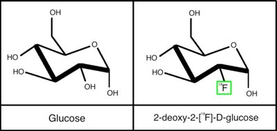 Structure of glucose and fluorodeoxyglucose