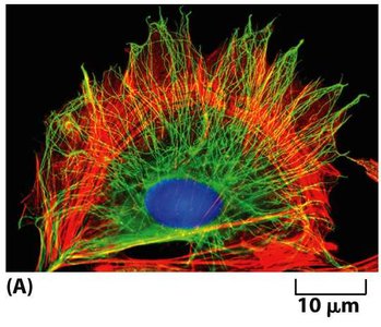 Labeled microtubules and actin filaments in a cultured cell