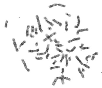 Metaphase spread and karyotype