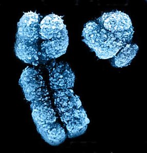 Scanning electron micrograph of X and Y chromosomes