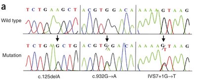 Sanger sequencing chromatogram showing mutations