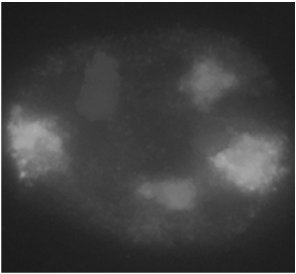 Fluorescent labeling of chromosome territories in the nucleus