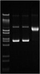 Diagram of negative, relaxed, and positive supercoiled DNA