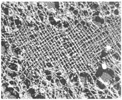 Surface view of nuclear lamina