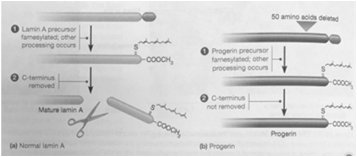 Diagram comparing normal lamin A processing and progerin in progeria