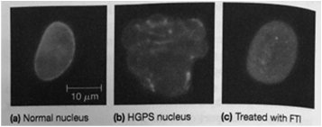 Images of normal, HGPS, and treated nuclei