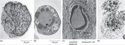 Apoptosis vs necrosis