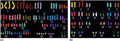 Genomic instability and aneuploidy