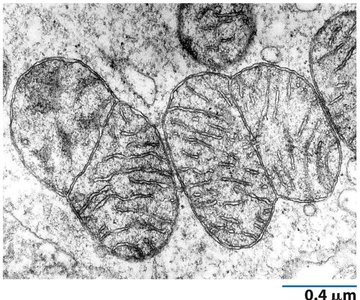 Mitochondrial morphology and fission