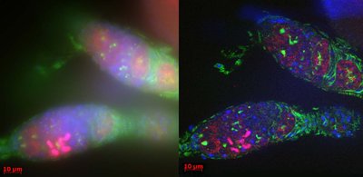 Comparison of brightfield and confocal microscopy images of fly ovaries