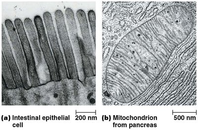 Transmission electron microscope (TEM)