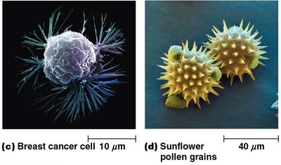 Electron micrographs of intestinal epithelial cell and mitochondrion