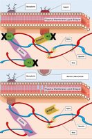Deficiency of protein 4.2 in hereditary spherocytosis