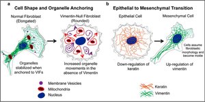 Role of intermediate filaments in cell architecture and function