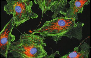Fluorescent image of actin filaments in cultured cells