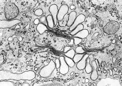 Transmission electron micrograph of Golgi apparatus