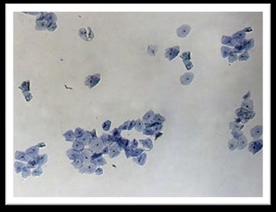 Cluster of stained squamous epithelial cells from oral mucosa