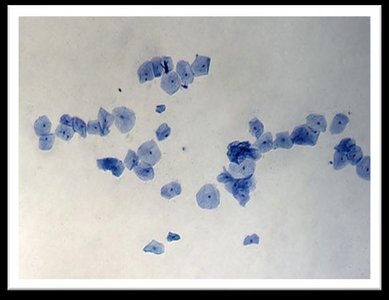 Sheet of squamous epithelial cells stained with methylene blue