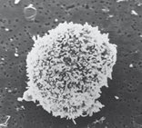 Apoptotic thymocyte