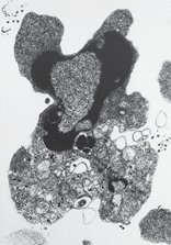 Normal thymocyte (scanning electron micrograph)