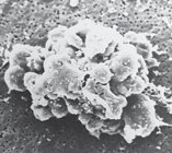 Apoptotic thymocyte (scanning electron micrograph)