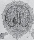 Blast cell