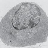 Plasma cell