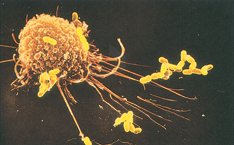 Macrophage pseudopodia extending toward bacteria
