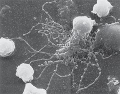 Follicular dendritic cells with beaded dendrites