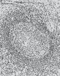Secondary lymphoid follicle with germinal center