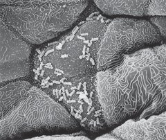 Electron micrograph of Escherichia coli adhering to epithelial cells