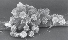 Bone-marrow cells in long-term culture