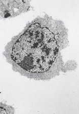 Normal thymocyte