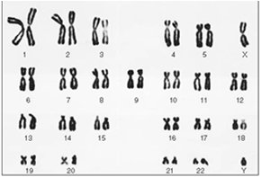 Human karyotype showing pairs of chromosomes