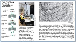 Transmission electron microscopy diagram