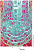 Stained section of plant root tip