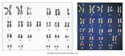 Human karyotype