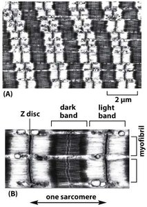 Electron micrograph of sarcomeres in myofibrils